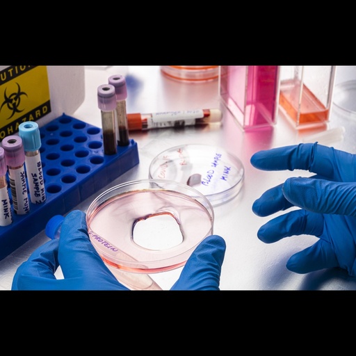 High-Range 1 Protein Marker (20 - 220 kDa)